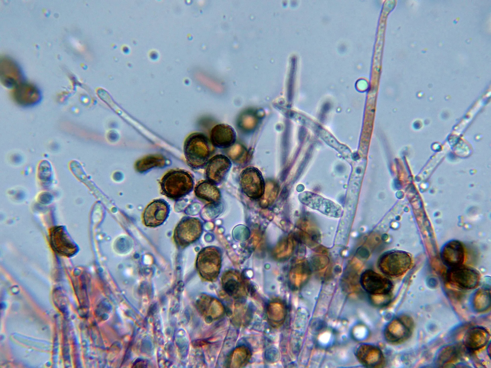 Microscopía de Sporophagomyces chrysostomus - 6 - Hifas-001